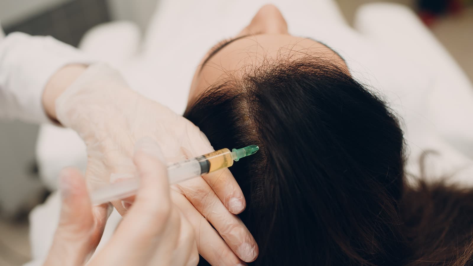 A scalp treatment in progress at The Aesthetic Edge