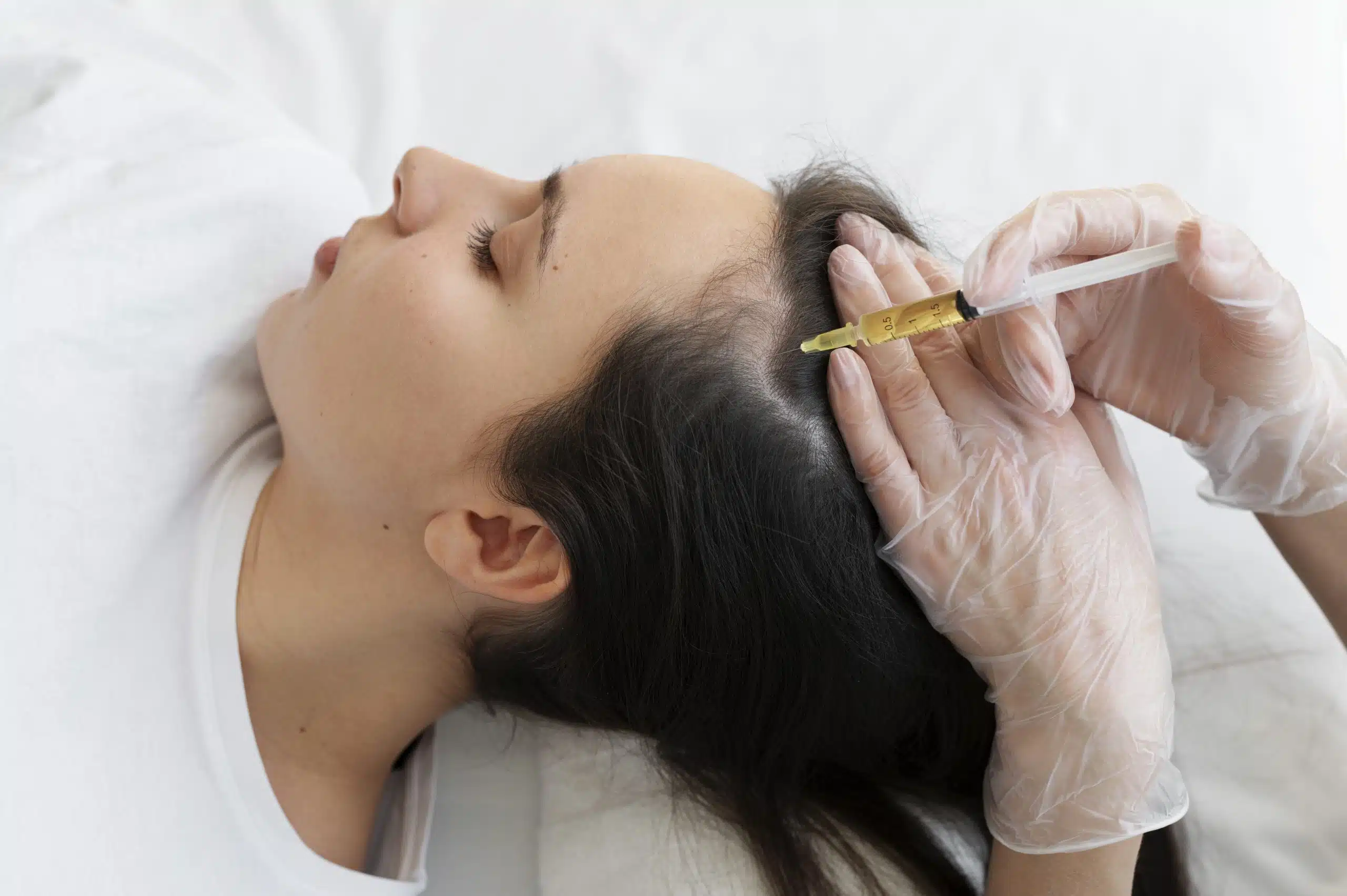 Scalp injection treatment at The Aesthetic Edge