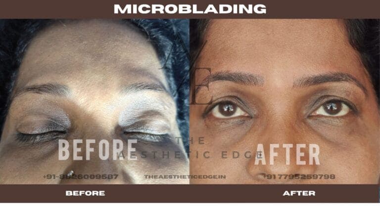 Eyebrow microblading second case, before and after