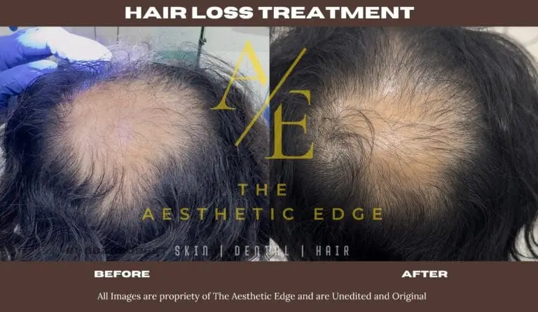 Hair regrowth before and after