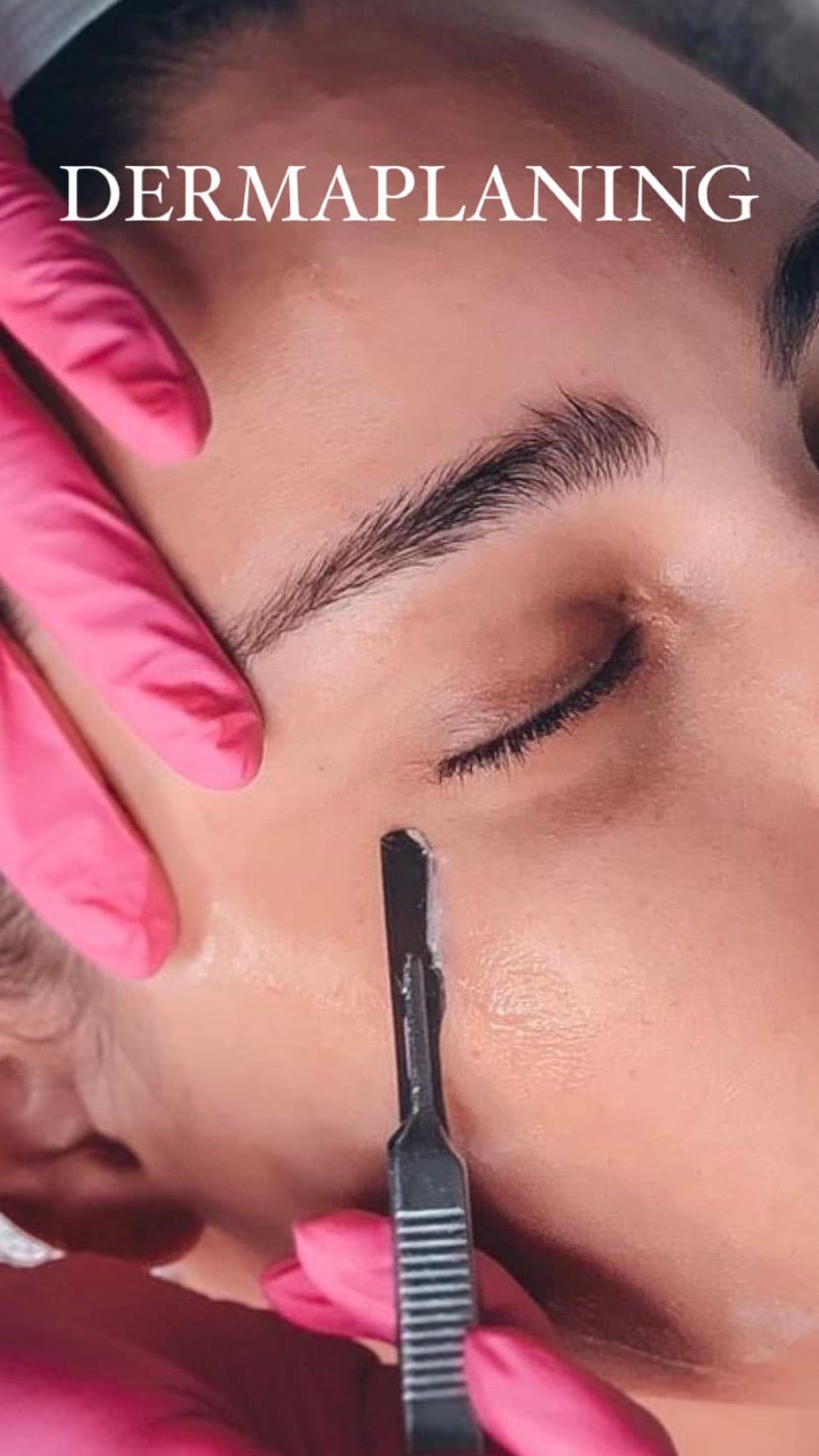 Dermaplaning in progress at The Aesthetic Edge, blade held flat against the cheek