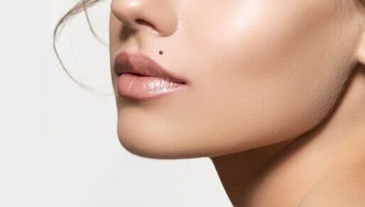 A single cosmetic beauty spot placed above the lip, matched to the patient's skin tone