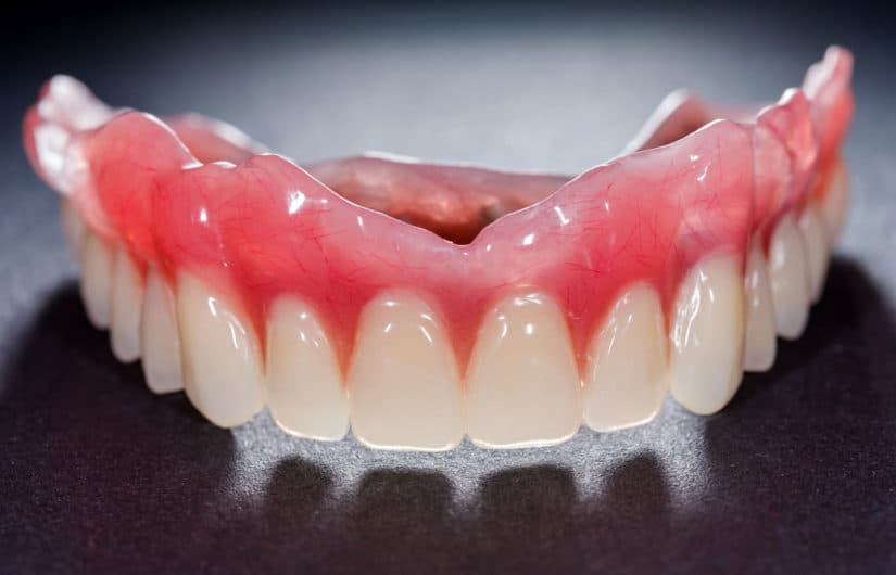 Custom-made full and partial dentures at The Aesthetic Edge, Bangalore