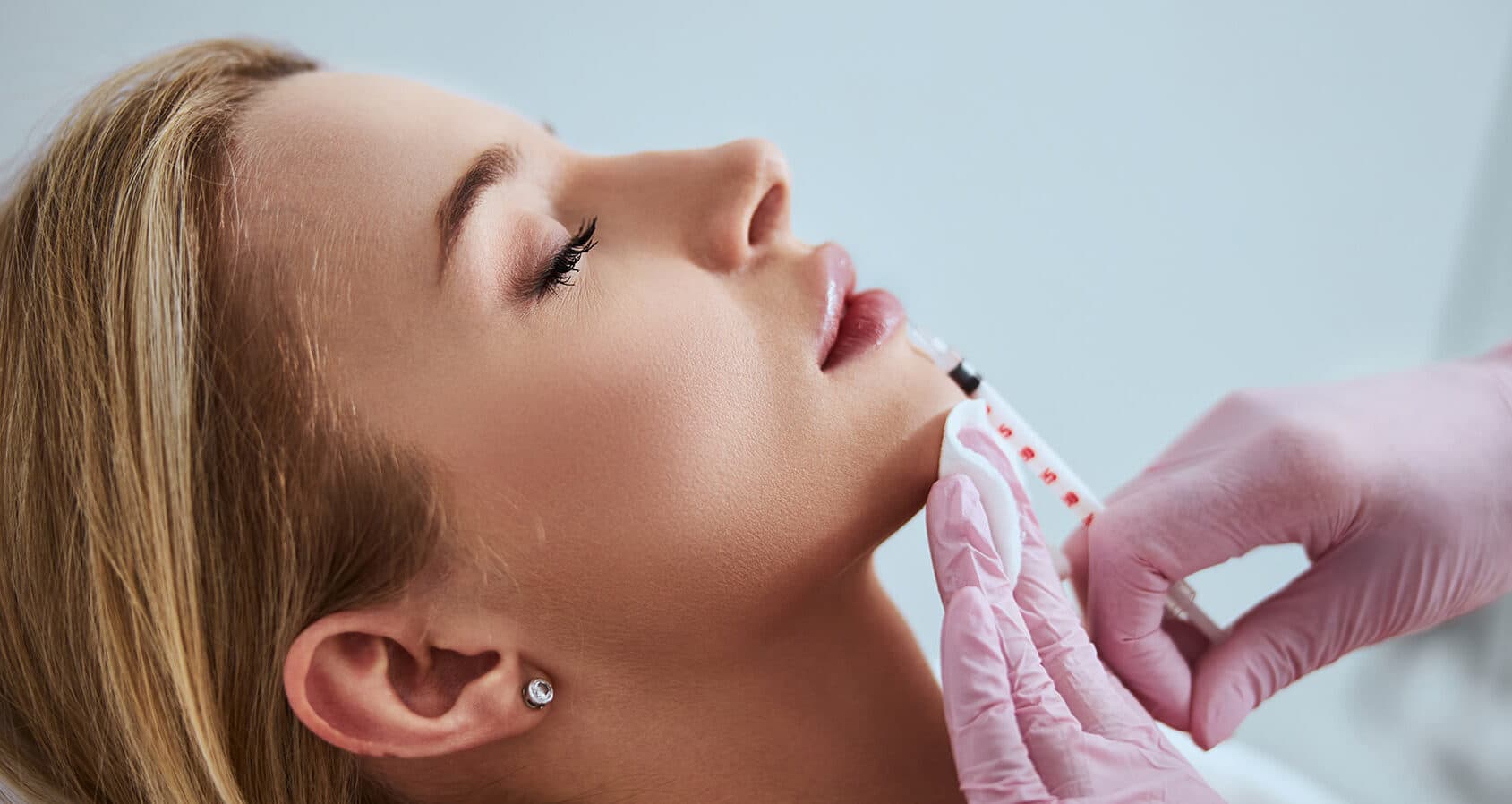 Micro-injection pattern being marked on a cheek before a Volite treatment