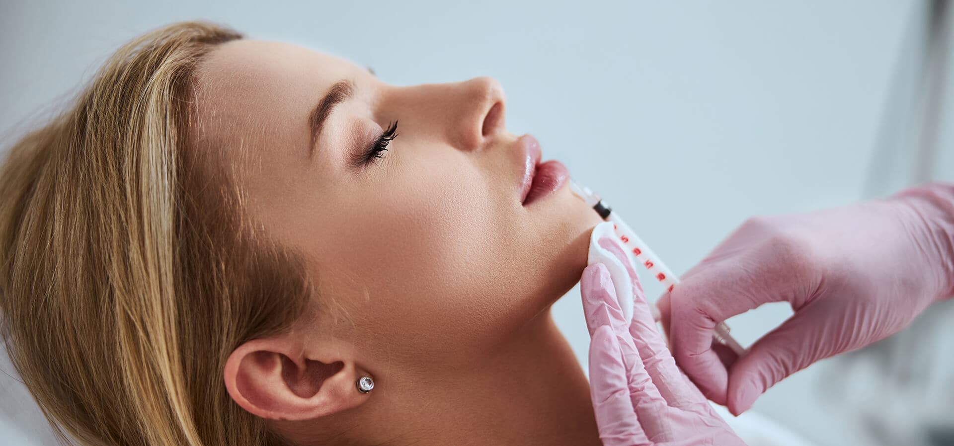 Dermal filler treatment