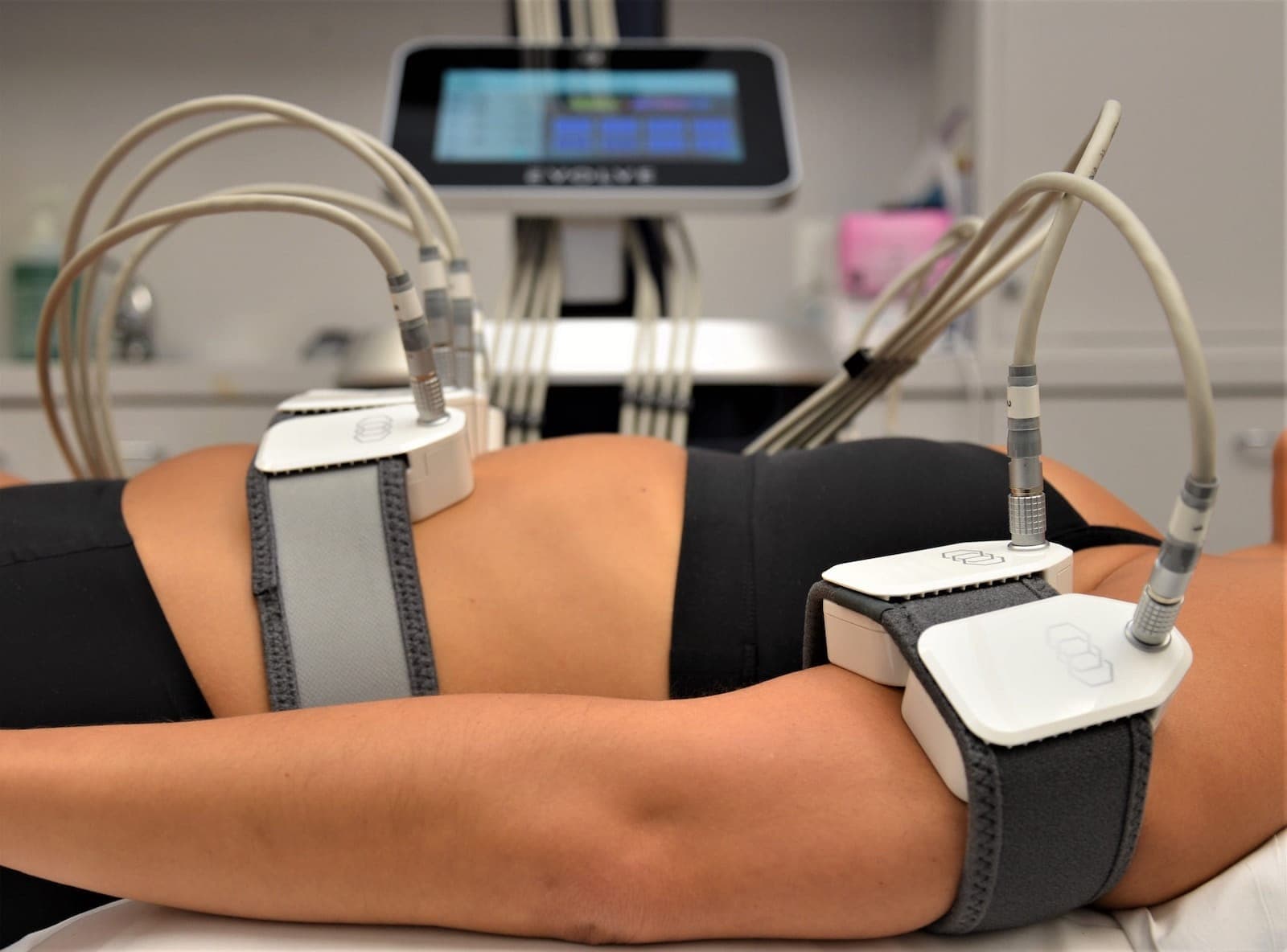 Hands-free Evolve applicators positioned on a patient's abdomen at The Aesthetic Edge