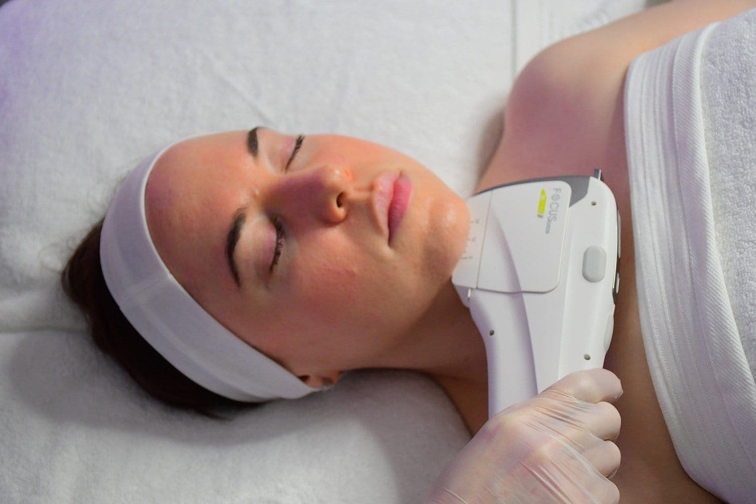 HIFU handpiece being applied along a patient's jawline at The Aesthetic Edge