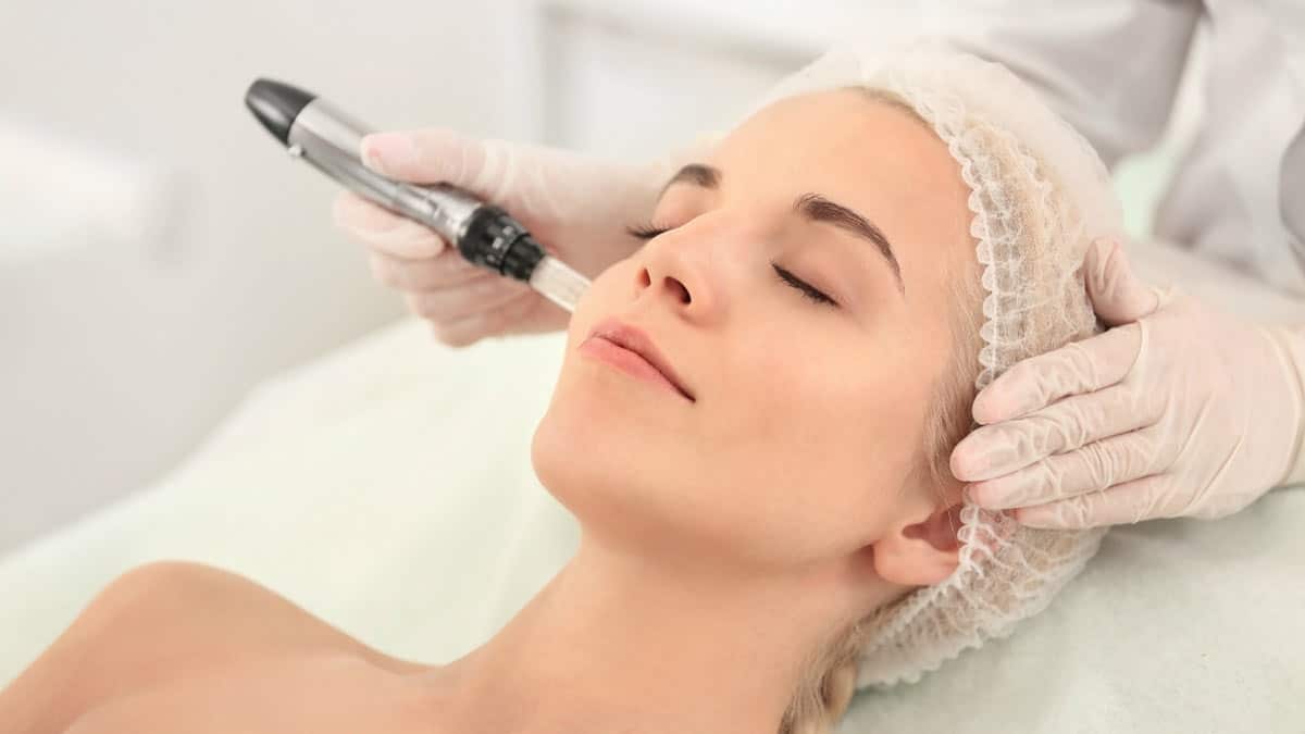 Microneedling with Dermapen