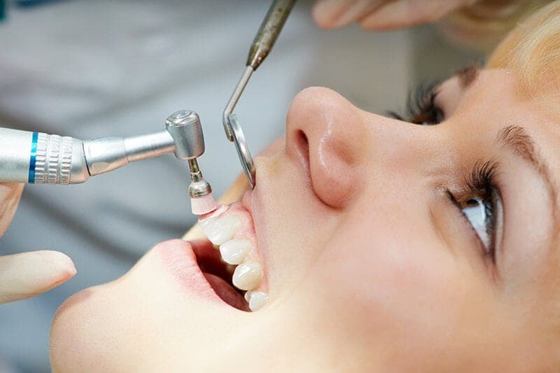 Routine preventive dental check-up at The Aesthetic Edge, Bangalore