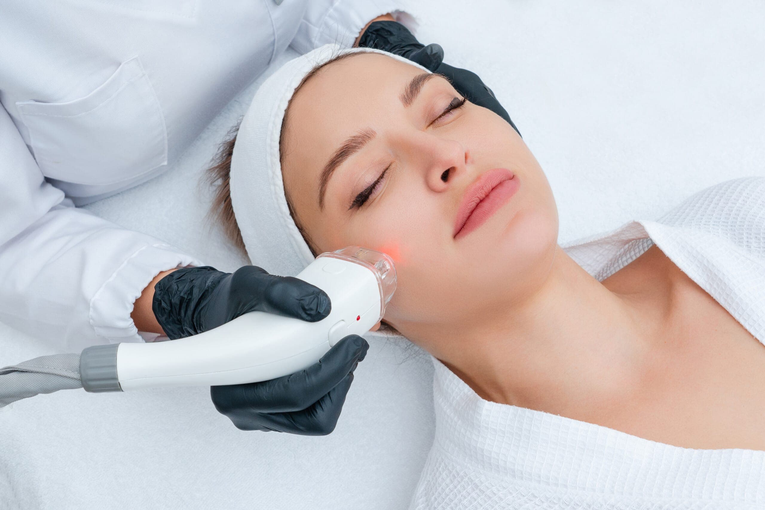 A Q-Switch laser session being performed at The Aesthetic Edge, Bangalore