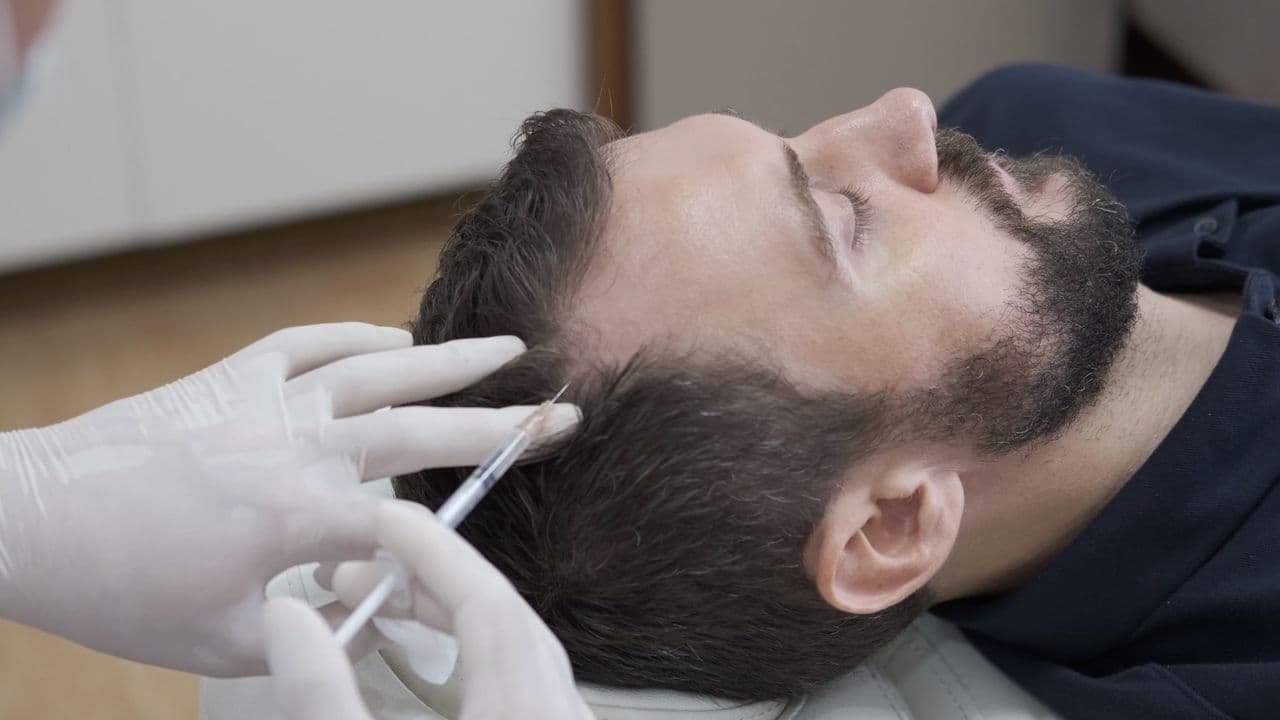 QR678 growth factor solution being injected into a patient's scalp at The Aesthetic Edge