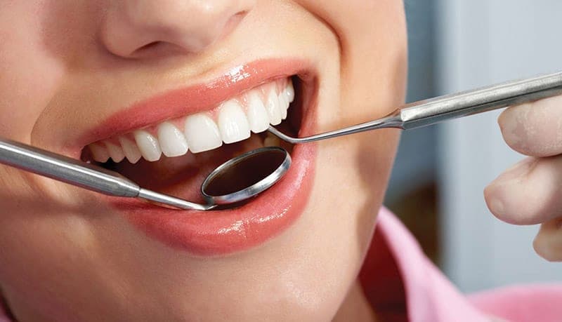 Professional dental scaling and polishing at The Aesthetic Edge, Bangalore