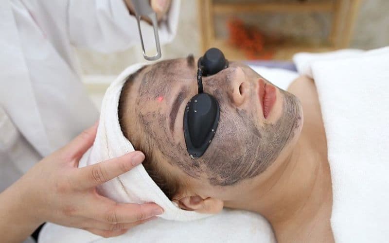A carbon laser peel being performed at The Aesthetic Edge, Bangalore