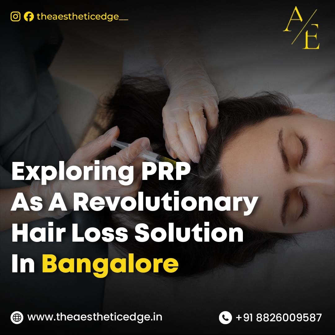 Exploring PRP as a Revolutionary Hair Loss Solution in Bangalore
