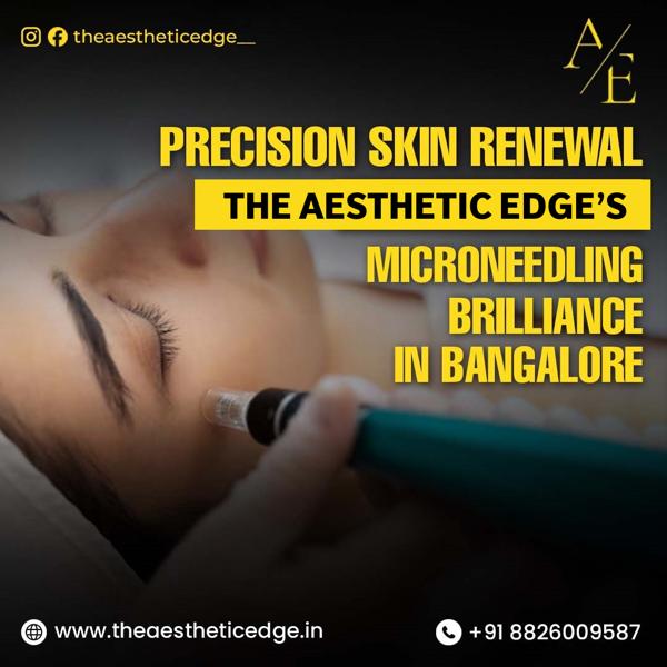 Unveiling Brilliance with Precision Skin Renewal through Microneedling in Bangalore