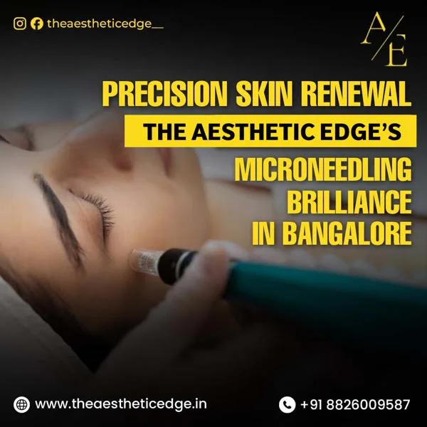 Unveiling Brilliance with Precision Skin Renewal through Microneedling in Bangalore