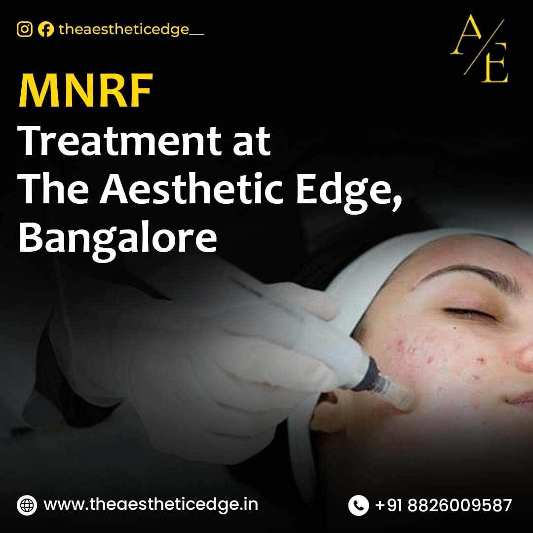MNRF Treatment at The Aesthetic Edge, Bangalore: Transform Your Skin with Advancements