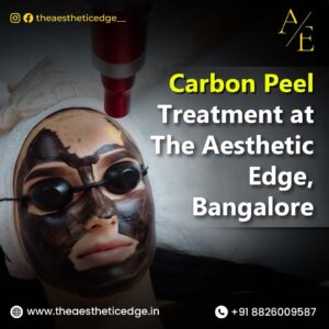Carbon Peel Treatment