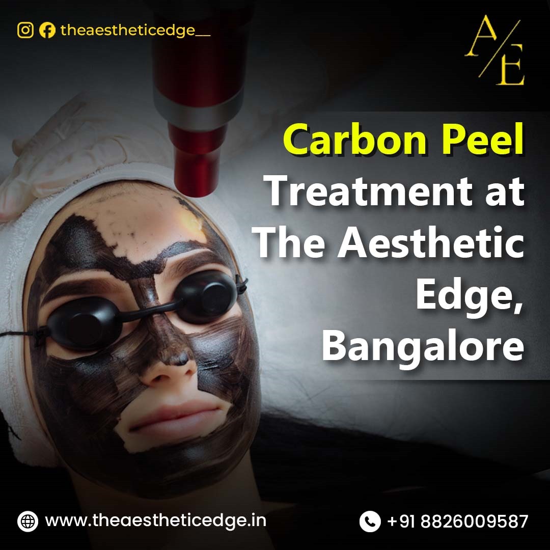 Carbon Peel Treatment at The Aesthetic Edge, Bangalore