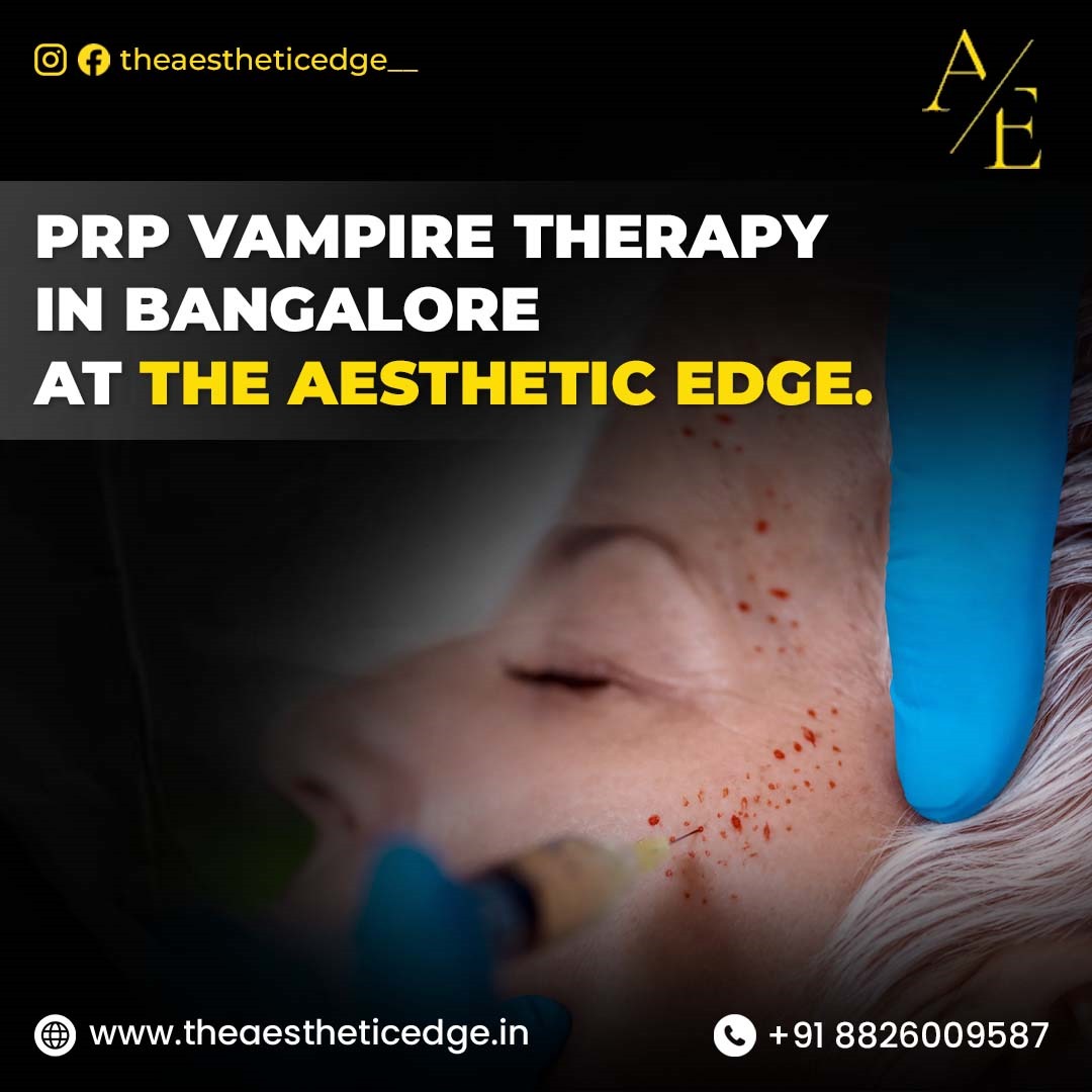 Prp Vampire Therapy in Bangalore at The Aesthetic Edge