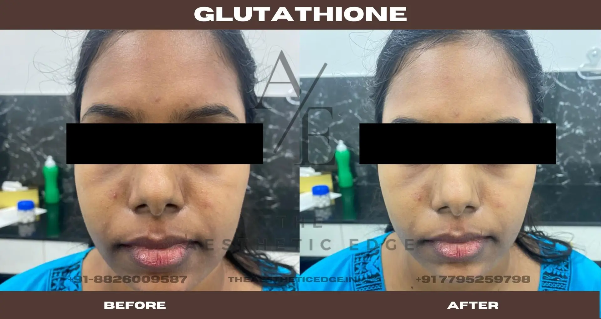 Glutathione results