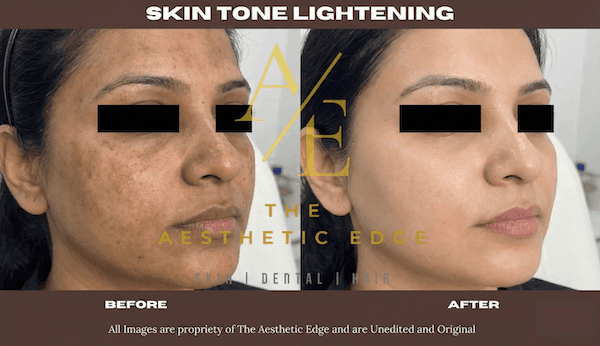 face lightening-compressed